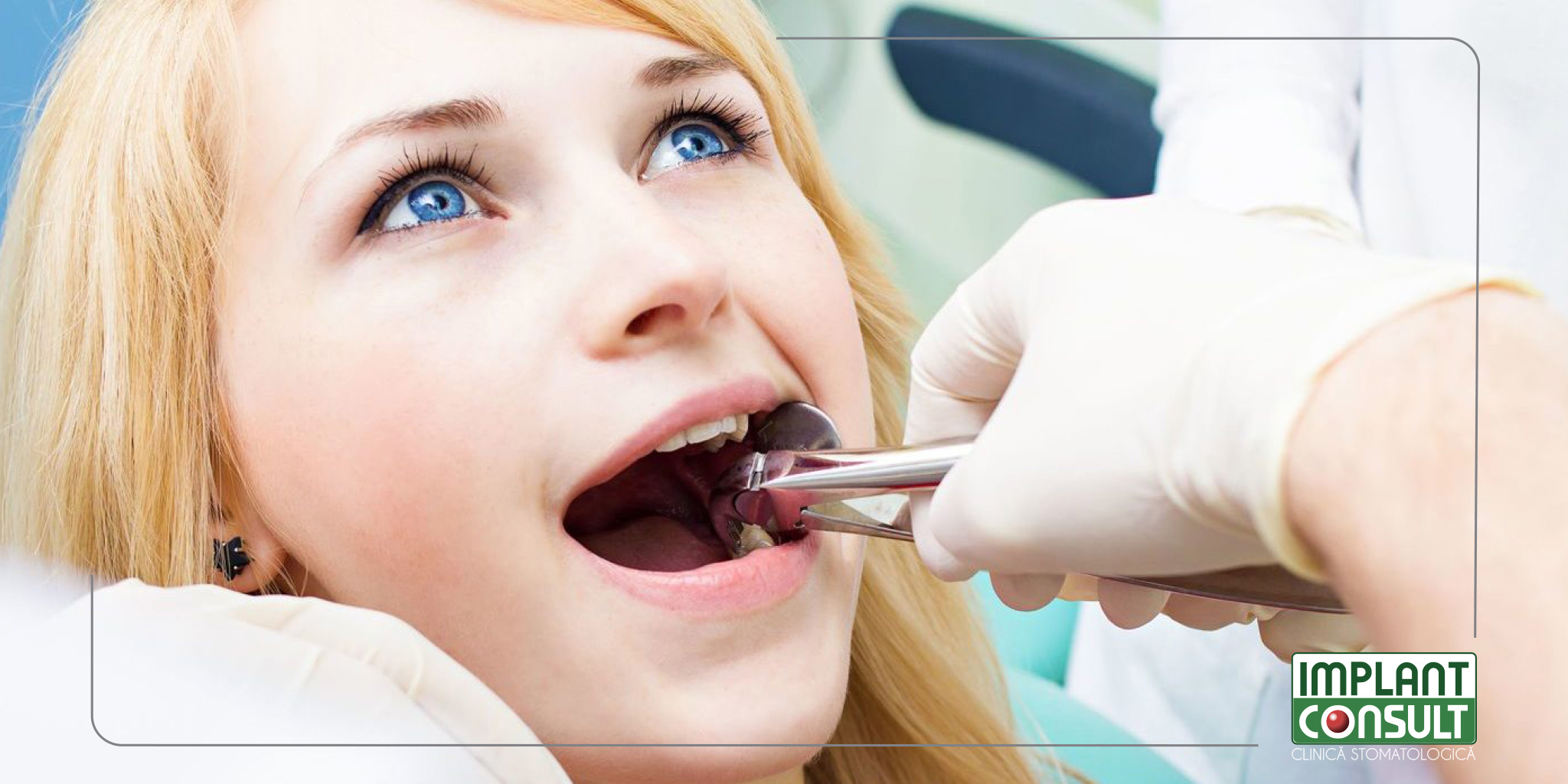 Ce să faceți și ce să nu faceți după o extracție dentară, pentru a vă reface cât mai rapid